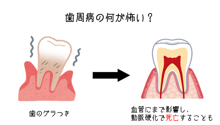 periodontal disease is bad
